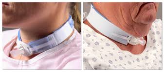 Dale Tracheostomy Tube Holders - Image 5