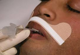 Dale Stabilock Endotracheal Tube Holder - Image 5