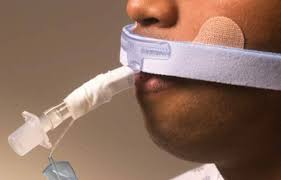 Dale Stabilock Endotracheal Tube Holder - Image 4