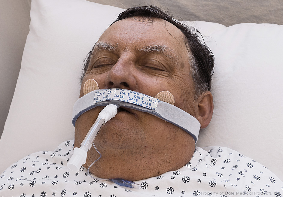 Dale BreezeLock® Endotracheal Tube Holder