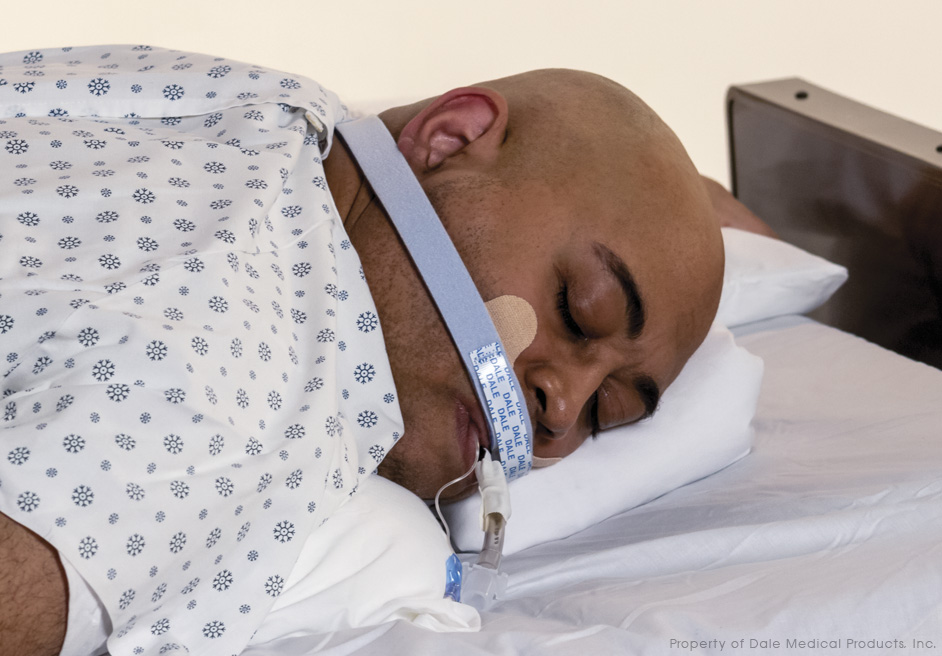 Dale BreezeLock® Endotracheal Tube Holder - Image 5