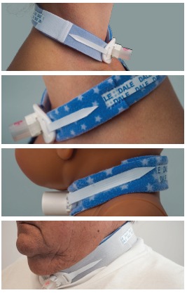Dale Tracheostomy Tube Holders - Image 2