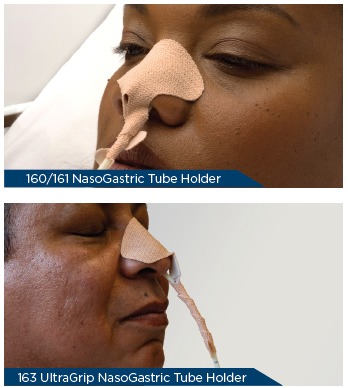 Dale NasoGastric Tube Holders - Image 2